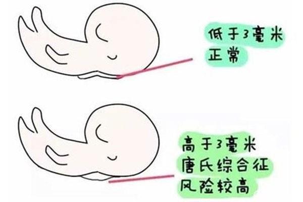 广州试管婴儿三代试管的区别