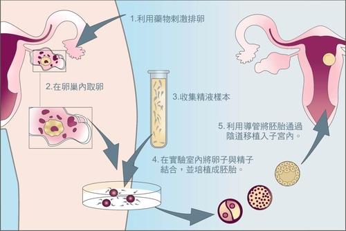 广州试管婴儿成功率是多少试管中的九点不能忽视!