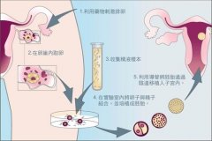 广州40岁供卵生殖中心:广州中医药大学附属第一医院有一个生殖中心，大约需要
