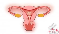 卵巢早衰的原因是什么？