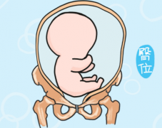 周口43岁助孕龙凤胎：第38周胎位不正的原因,孕晚期胎位不正的原因是什么？