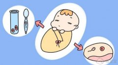 沈阳助孕联系方式：沈阳精英医院的试管婴儿过程是怎样的？